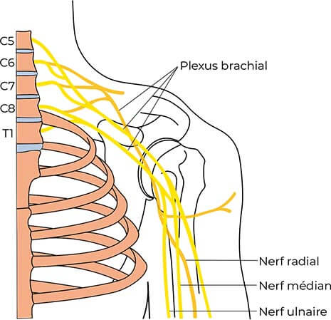 Plexus brachial - névralgie cervicobrachiale