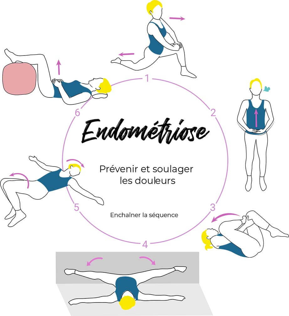 Endométriose - La calmer par des exercices d'ostéopathe