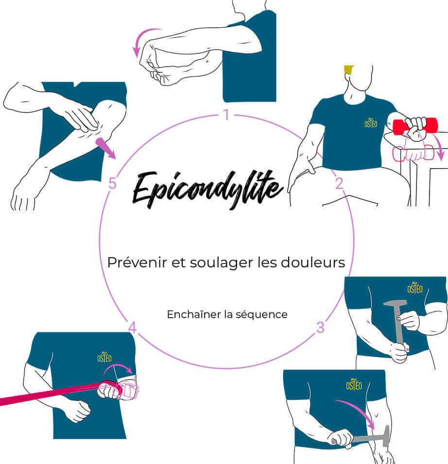 Exercice pour epicondylite
