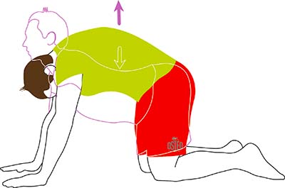 Assouplissement spondylolisthesis