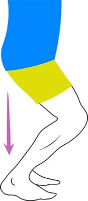 Étirement tendinite du tendon d'Achille